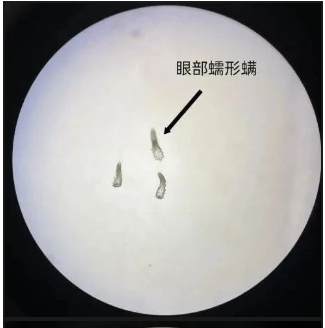 那些纹美瞳线的人现在都怎么样了？