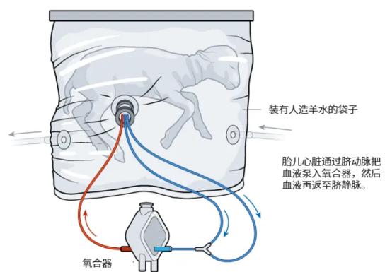 飙上热搜的人造子宫真的能让男人也怀孕？