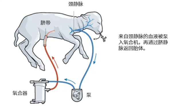 飙上热搜的人造子宫真的能让男人也怀孕？