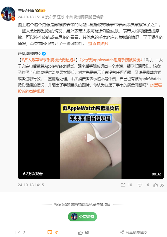 女子戴AppleWatch睡觉被烫伤起泡苹果客服回应：过敏反应